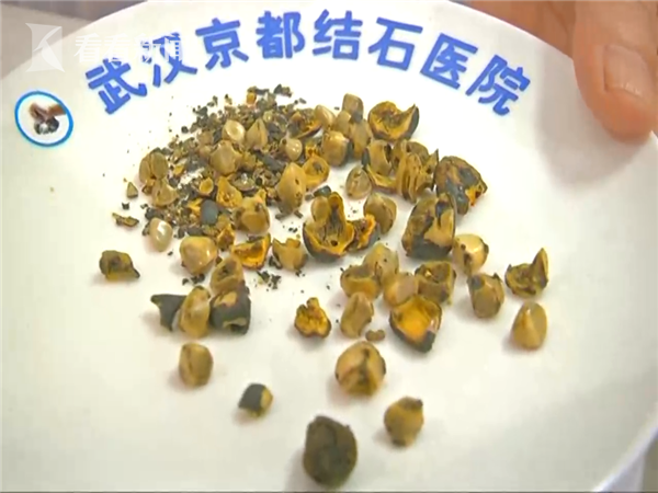 “jiuyou”中牟河务局明确下半年经济